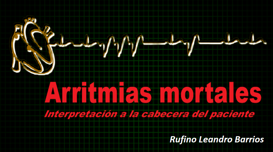 ARRITMIAS