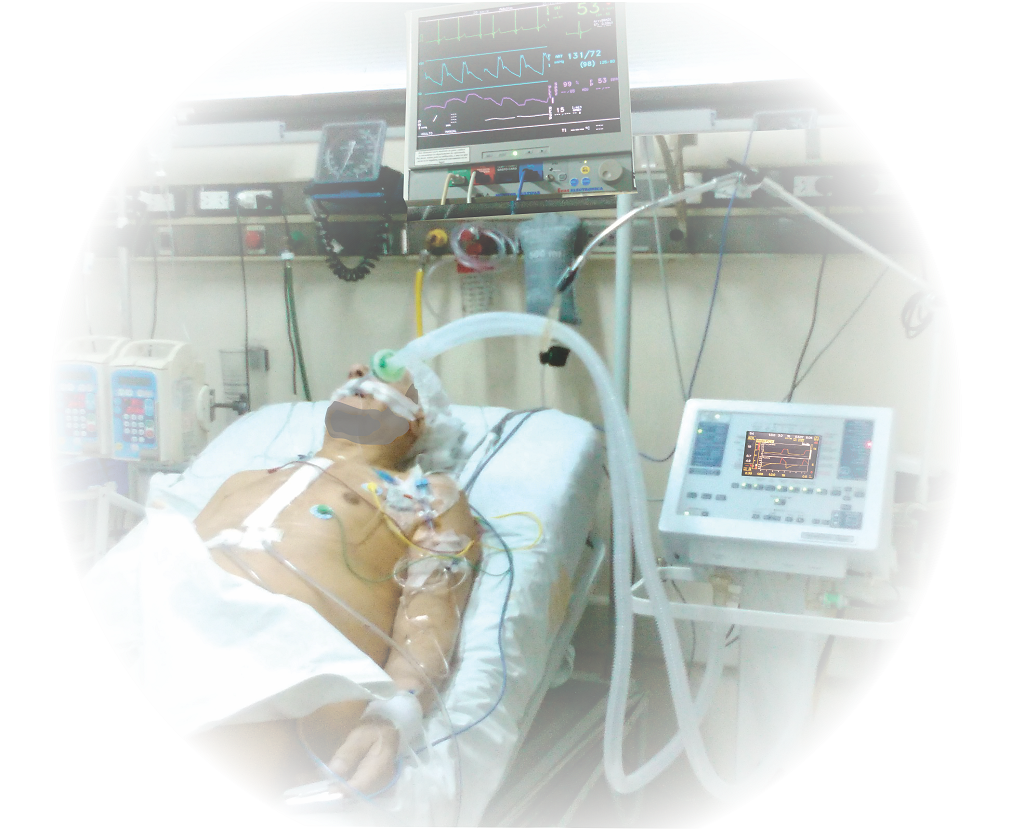 RECUPERACION