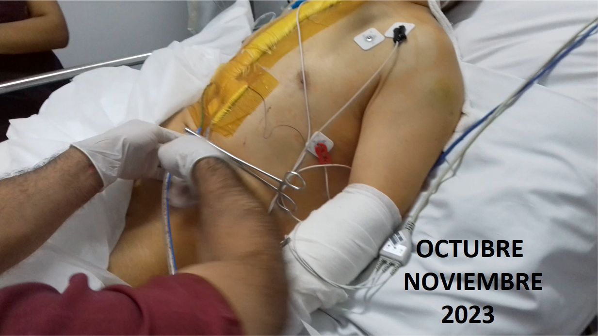Recuperación