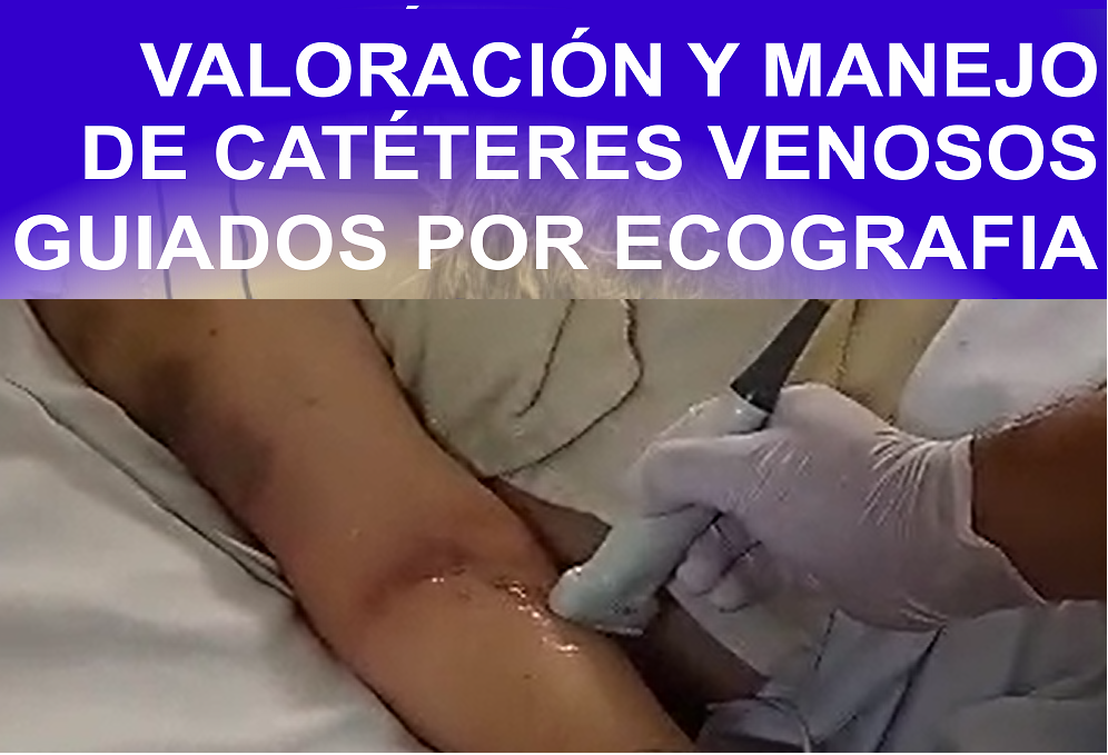 Valoración